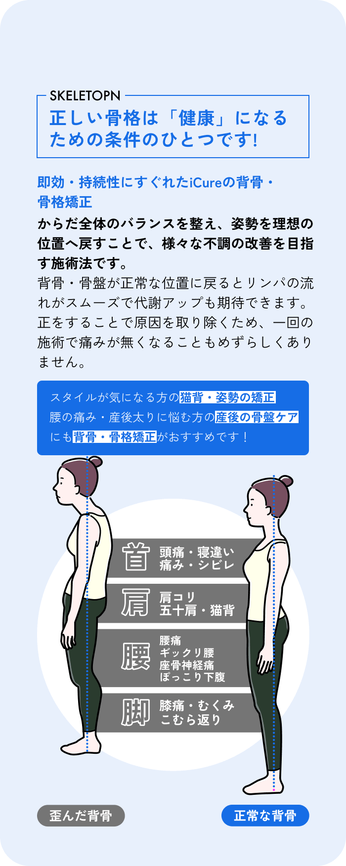正しい骨格と歪んだ骨格の比較図
